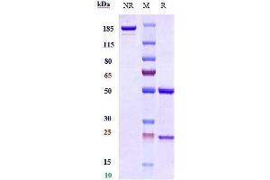 Anti-B7-H1 / PD-L1 / CD274 Reference Antibody (MDX-1105) on SDS-PAGE under reducing (R) condition.
