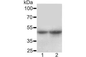 Western blot testing of SLC10A1 antibody and Lane 1:  rat liver (SLC10A1 anticorps  (AA 141-154))