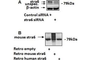 ABIN5539909 (1. (STRA6 anticorps  (C-Term))
