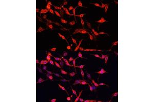Immunofluorescence analysis of PC-12 cells using ENO3 antibody (ABIN7266960) at dilution of 1:100.