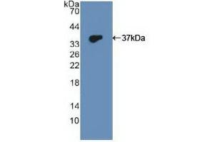 Detection of Recombinant DUSP6, Human using Polyclonal Antibody to Dual Specificity Phosphatase 6 (DUSP6)