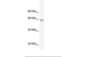 Image no. 1 for anti-Metal-Regulatory Transcription Factor 1 (MTF1) (AA 562-611) antibody (ABIN202901)