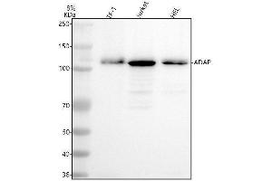 anti-FYN-Binding Protein 1 (FYB1) antibody
