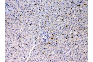 PSAT1 was detected in paraffin-embedded sections of rat liver tissues using rabbit anti- PSAT1 Antigen Affinity purified polyclonal antibody (Catalog # ) at 1 µg/mL.