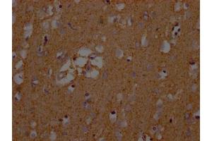 IHC image of ABIN7152226 diluted at 1:200 and staining in paraffin-embedded human brain tissue performed on a Leica BondTM system.