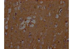 IHC image of ABIN7152226 diluted at 1:200 and staining in paraffin-embedded human brain tissue performed on a Leica BondTM system. (SLC1A3 anticorps  (AA 146-236))