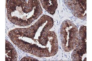 Immunohistochemistry (IHC) image for anti-T-cell surface glycoprotein CD1c (CD1C) antibody (ABIN1497187)