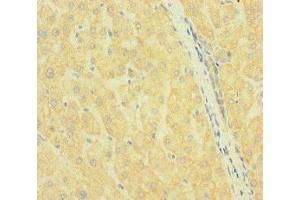 Immunohistochemistry of paraffin-embedded human liver tissue using ABIN7169972 at dilution of 1:100 (SLC38A9 anticorps  (AA 1-119))