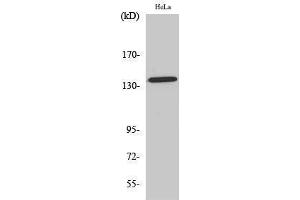 Western Blotting (WB) image for anti-Amyloid beta (Abeta) (pThr743) antibody (ABIN3173356) (beta Amyloid anticorps  (pThr743))