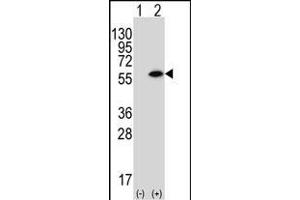 Western blot analysis of CSIN1 (arrow) using rabbit polyclonal CSIN1 Antibody (G23) (ABIN392664 and ABIN2842162).