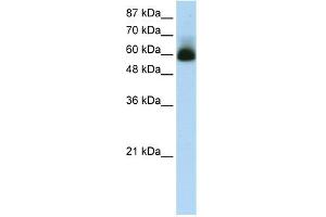 WB Suggested Anti-ZNF307 Antibody Titration:  1. (ZKSCAN4 anticorps  (N-Term))