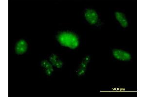Immunofluorescence of purified MaxPab antibody to PIK3R3 on HeLa cell. (PIK3R3 anticorps  (AA 1-461))