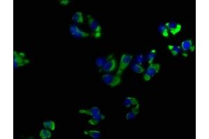 Immunofluorescence staining of HepG2 cells with ABIN7139899 at 1:50, counter-stained with DAPI. (OPRK1 anticorps  (AA 31-50))