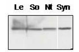 Western blot analysis of chloroplast proteins from tomato (Lycopersicum esculentum, Le, spinach (Spinacia oleracea, So), tobacco (Nicotiana tabacum, Nt) and membrane proteins from Synechocystis sp. (PsbQ anticorps)