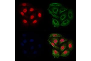 ABIN6255287 and ABIN6267691 staining Hela cells(4h of LPS treatment) by IF/ICC. (RACGAP1 anticorps  (pSer387))