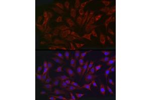 Immunofluorescence analysis of NIH/3T3 cells using NLRP1 antibody (ABIN7268935) at dilution of 1:200.
