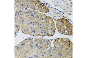 Immunohistochemistry of paraffin-embedded human stomach using THBS2 antibody (ABIN5996361) at dilution of 1/100 (40x lens). (Thrombospondin 2 anticorps)