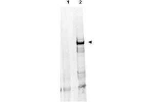 Anti-ATM Monoclonal Antibody - Western Blot Anti ATM Mab with human derived HEK293 cells treated with doxorubicin using  Protein A Purified Mab anti-ATM Protein Kinase pS1981(clone 10H11. (ATM anticorps  (pSer1981))