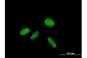 Immunofluorescence of purified MaxPab antibody to ZNF584 on HepG2 cell. (ZNF584 anticorps  (AA 1-421))