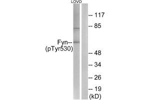 Western blot analysis of extracts from LOVO cells, using Fyn (Phospho-Tyr530) antibody (ABIN5975908). (FYN anticorps  (pTyr530))
