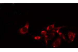 ABIN6275148 staining  Hela cells by IF/ICC. (GJC1 anticorps  (C-Term))