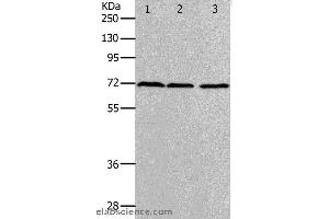 Western blot analysis of K562, hela and 293T cell, using PRMT5 Polyclonal Antibody at dilution of 1:400 (PRMT5 anticorps)