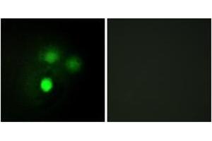 Immunofluorescence analysis of HuvEc cells, using KNTC2 Antibody. (NDC80 anticorps  (AA 351-400))