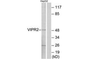 Western blot analysis of extracts from HepG2 cells, using VIPR2 Antibody.