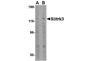 Image no. 1 for anti-SLIT and NTRK-Like Family, Member 3 (SLITRK3) (C-Term) antibody (ABIN1493361)