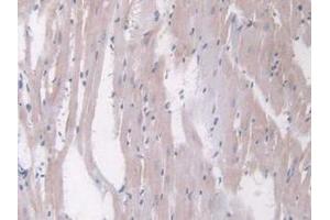 IHC-P analysis of Rat Heart Tissue, with DAB staining. (Angiopoietin 1 anticorps  (AA 304-450))
