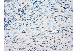 Immunohistochemical staining of paraffin-embedded Ovary tissue using anti-SSBmouse monoclonal antibody. (SSB anticorps)