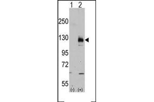 Image no. 2 for anti-Transient Receptor Potential Cation Channel, Subfamily M, Member 8 (TRPM8) (C-Term) antibody (ABIN360717) (TRPM8 anticorps  (C-Term))