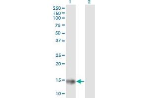 Western Blot analysis of ACP1 expression in transfected 293T cell line by ACP1 monoclonal antibody (M06), clone 2A3.