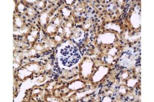 Formalin-fixed and paraffin embedded mouse kidney labeled with Anti-MCP1/CCL2 Polyclonal Antibody, Unconjugated  at 1:200 followed by conjugation to the secondary antibody and DAB staining.