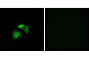 Immunofluorescence analysis of A549 cells, using VN1R5 antibody. (VN1R5 anticorps)