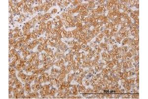 Image no. 1 for anti-Receptor-Interacting Serine-threonine Kinase 4 (RIPK4) (AA 675-785) antibody (ABIN466213) (RIPK4 anticorps  (AA 675-785))