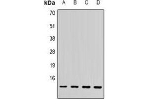 Western blot analysis of SSNA1 expression in PC3 (A), MCF7 (B), mouse spleen (C), rat brain (D) whole cell lysates. (SSNA1 anticorps)