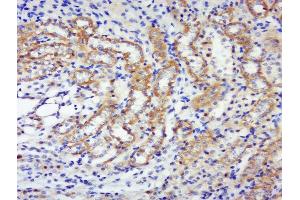Paraformaldehyde-fixed, paraffin embedded rat kidney, Antigen retrieval by boiling in sodium citrate buffer (pH6) for 15min, Block endogenous peroxidase by 3% hydrogen peroxide for 30 minutes, Blocking buffer (normal goat serum) at 37°C for 20min, Antibody incubation with p70 S6 Kinase Beta (Thr444 + Ser447) Antibody, Unconjugated  at 1:400 overnight at 4°C, followed by a conjugated secondary and DAB staining.
