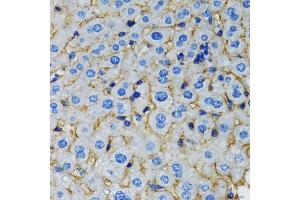 Immunohistochemistry of paraffin-embedded rat liver using RAF1 antibody (ABIN5970053) at dilution of 1/100 (40x lens). (RAF1 anticorps  (C-Term))