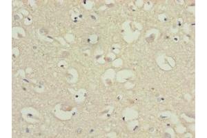 Immunohistochemistry of paraffin-embedded human brain tissue using ABIN7147813 at dilution of 1:100 (CMTM5 anticorps  (AA 1-35))