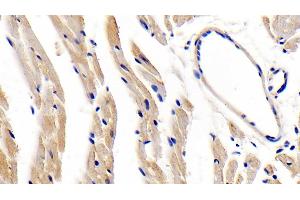 Detection of LEPR in Mouse Cardiac Muscle Tissue using Polyclonal Antibody to Leptin Receptor (LEPR)