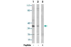 Western blot analysis of extracts from MCF-7 cells (Lane 1 and lane 3) and HepG2 cells (Lane 2), using NT5C1A polyclonal antibody . (NT5C1A anticorps)