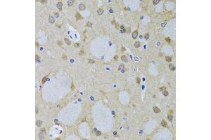 Immunohistochemistry of paraffin-embedded mouse brain using YWHAZ antibody (ABIN5975846) at dilution of 1/100 (40x lens). (14-3-3 zeta anticorps)