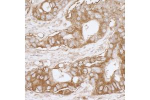 Immunohistochemistry (IHC) image for anti-Major Vault Protein (MVP) (AA 843-893) antibody (ABIN7453922)