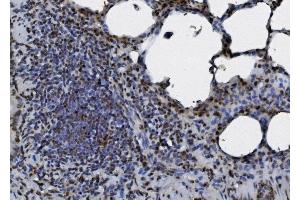 IHC analysis of hnRNP D/AUF1/HNRNPD using anti-hnRNP D/AUF1/HNRNPD antibody (ABIN7602591). (HNRNPD/AUF1 anticorps  (AA 88-246))