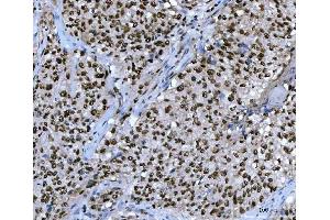 IHC analysis of Ubc13/UBE2N using anti-Ubc13/UBE2N antibody (ABIN7599924).
