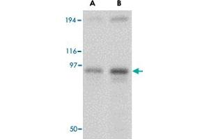 Western blot analysis of NUP107 in A-549 cell lysate with NUP107 polyclonal antibody  at (A) 1 and (B) 2 ug/mL . (NUP107 anticorps  (Internal Region))