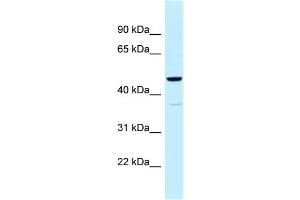 WB Suggested Anti-UQCRC1 Antibody Titration: 1. (UQCRC1 anticorps  (N-Term))