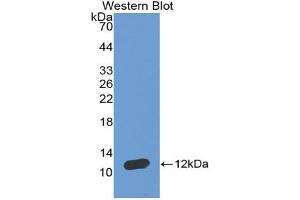 Western blot analysis of the recombinant protein. (NPPA anticorps  (AA 25-122))