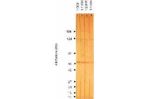 Western Blotting (WB) image for anti-CMV Glycoprotein B (CMV gB) antibody (ABIN265541) (CMV Glycoprotein B (CMV gB) anticorps)